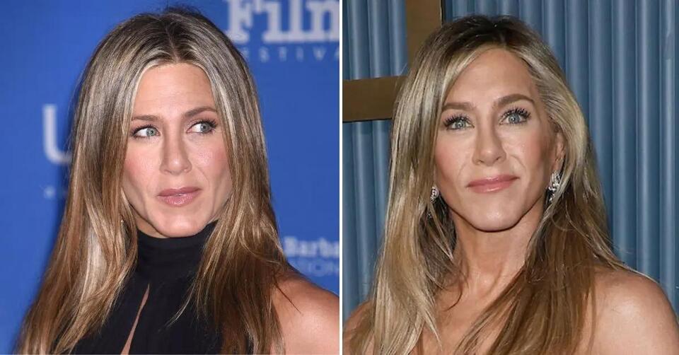 Secrets Of Jennifer Aniston's 'New Face' Revealed: 'Friends' Icon Accused  Of 'Getting a Lower Facelift' That 'Stretches Out The Mouth' - NewsBreak