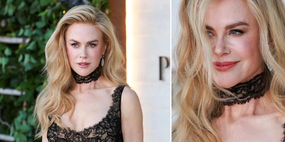 Fans Think Nicole Kidman Has Laid Off the Botox - NewsBreak