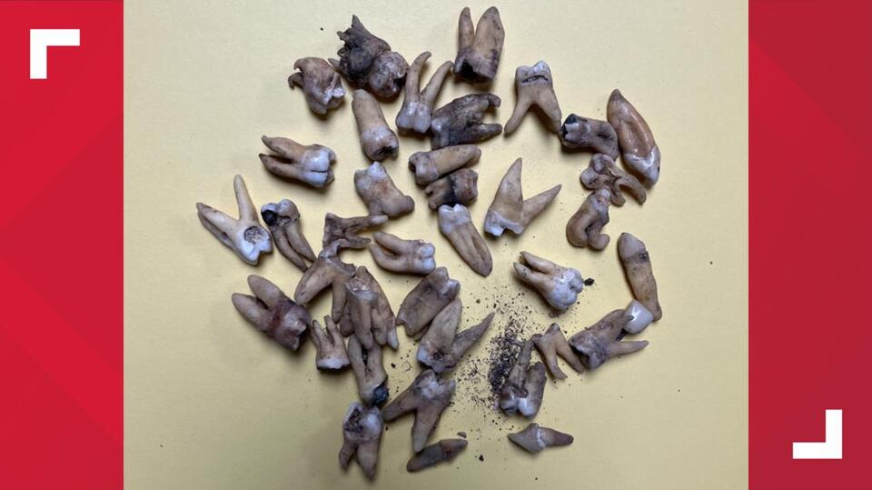 100 teeth found buried in Texas yard deemed 'old-school dental ...