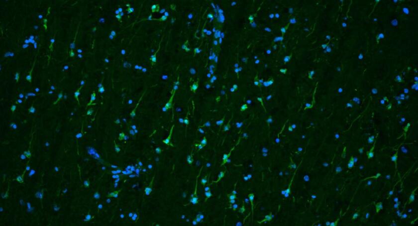 Study of Living Brain Tissue Reveals the Way Parkinson’s Treatment ...
