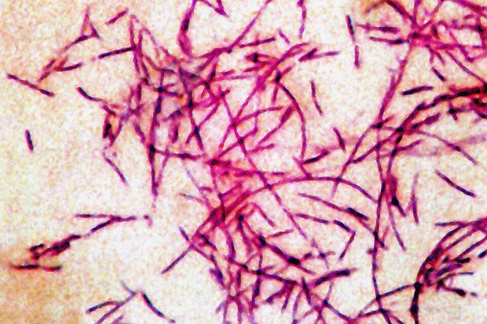 3rd person dies from Legionnaires' disease in New York City