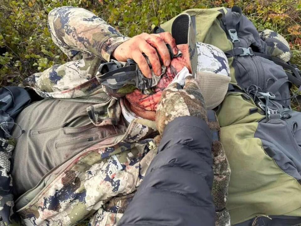 ‘I could hear all the bones crunching': man survives bear attack during caribou hunting trip