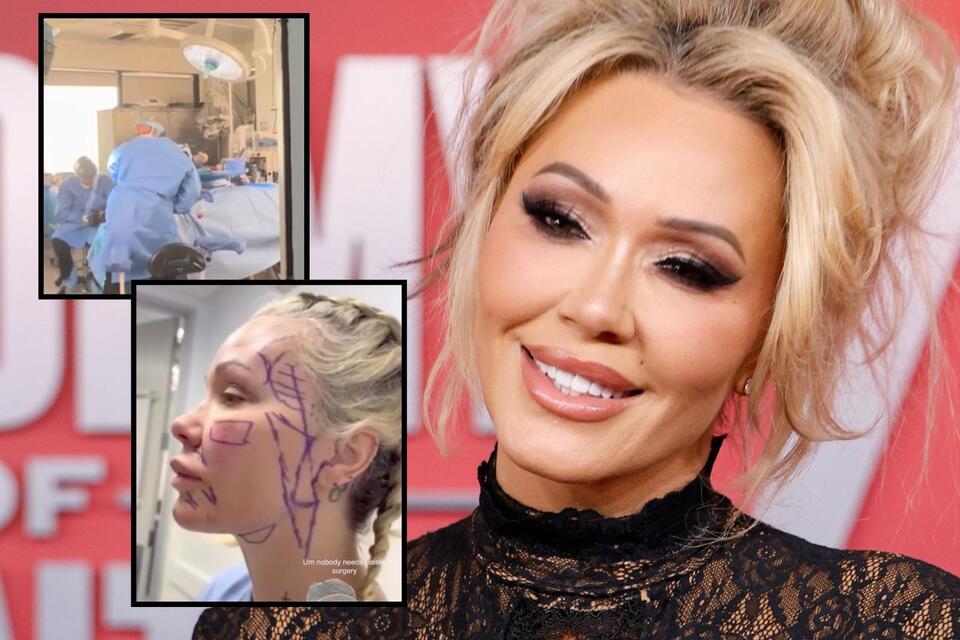 Watch Bunnie Xo's Facelift Surgery + See Before and After Pics NewsBreak
