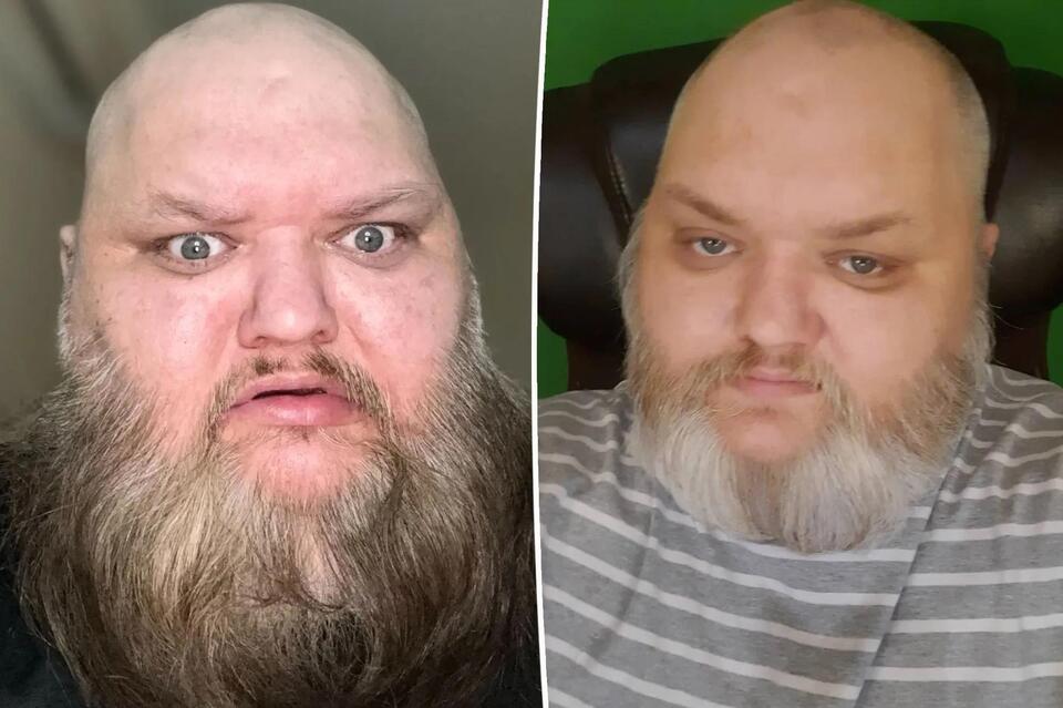 TikTok star John Crawley, known as 'KingBeardX,' dead at 47 - NewsBreak