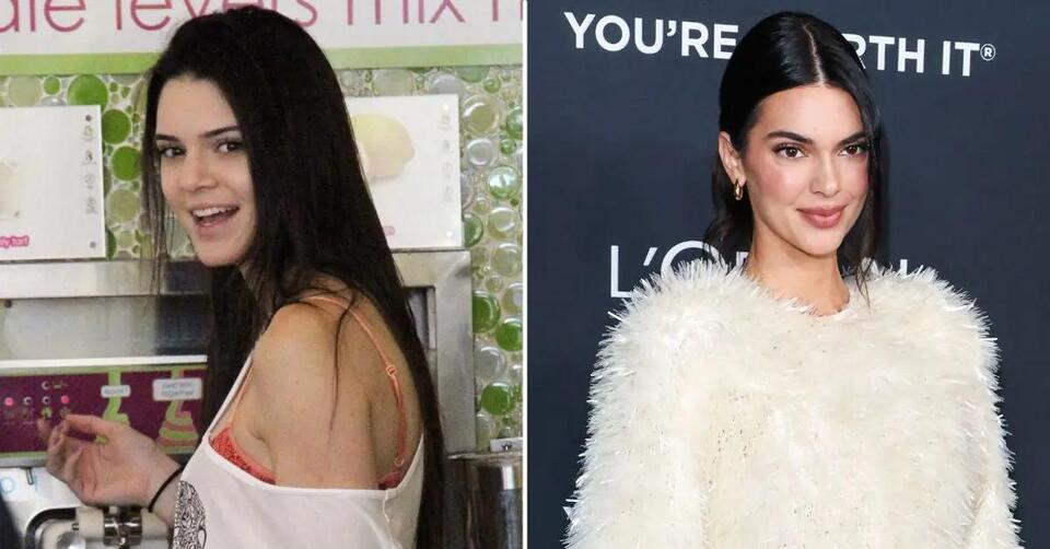 Kendall Jenner Sets the Record Straight on the 'Only' Cosmetic