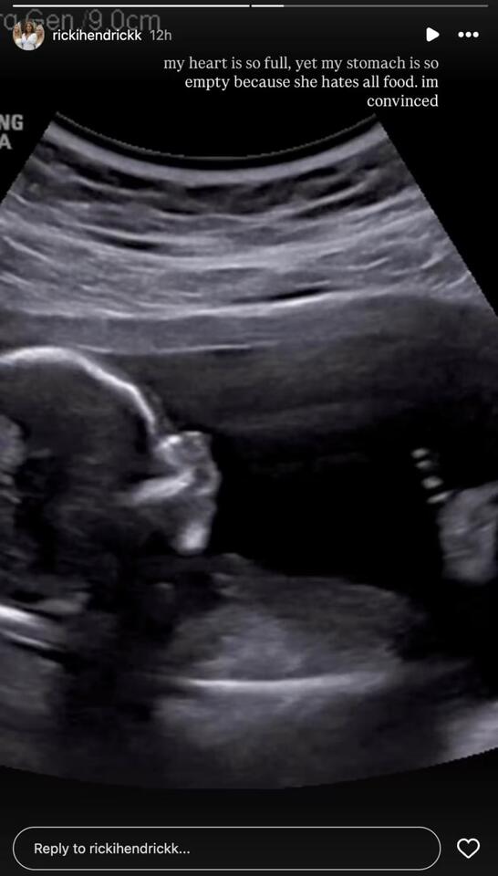 Emily Maynard Breaks Silence on 20YearOld Daughter Ricki's Pregnancy