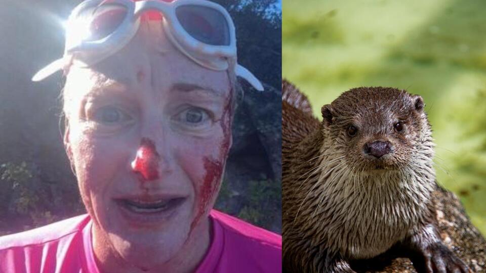 Woman Says Otter Pulled Her Underwater During Swim at Lake Tahoe, Leaving Her With 40 Stitches