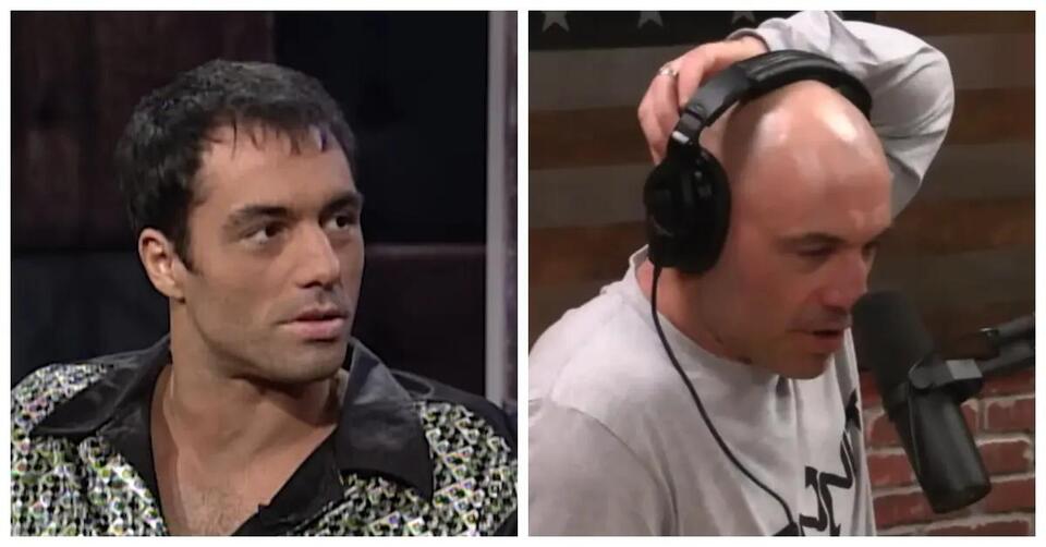 Joe Rogan Once Had a Failed Hair Transplant, and it Left Behind a Huge ...
