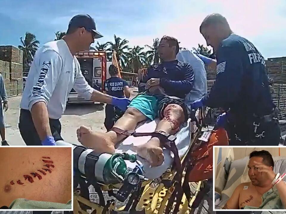 Fisherman attacked by bull shark near Key West: ‘He is lucky to be alive’