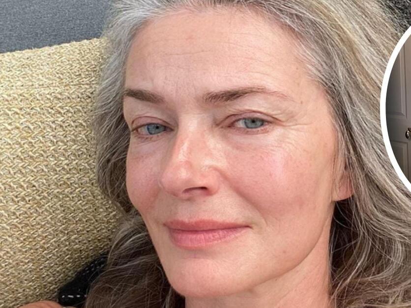 Paulina Porizkova Shows Off Hip Surgery Scars, Embraces Them As