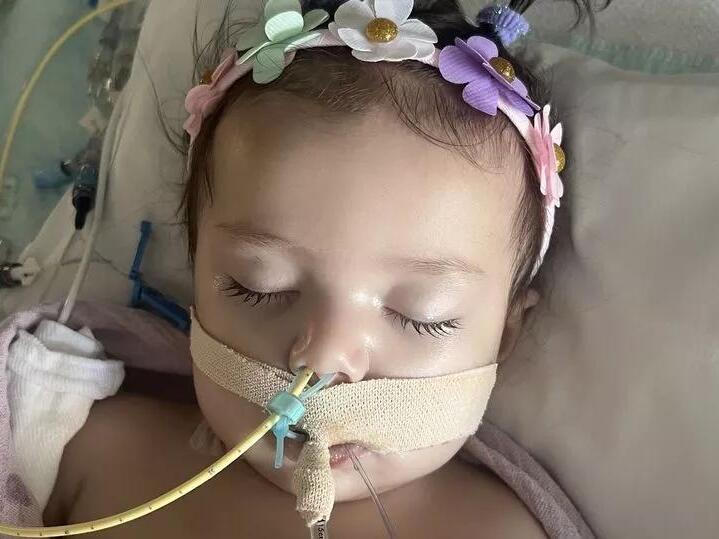 Baby's wheezing turned out to be swallowed button battery burning hole