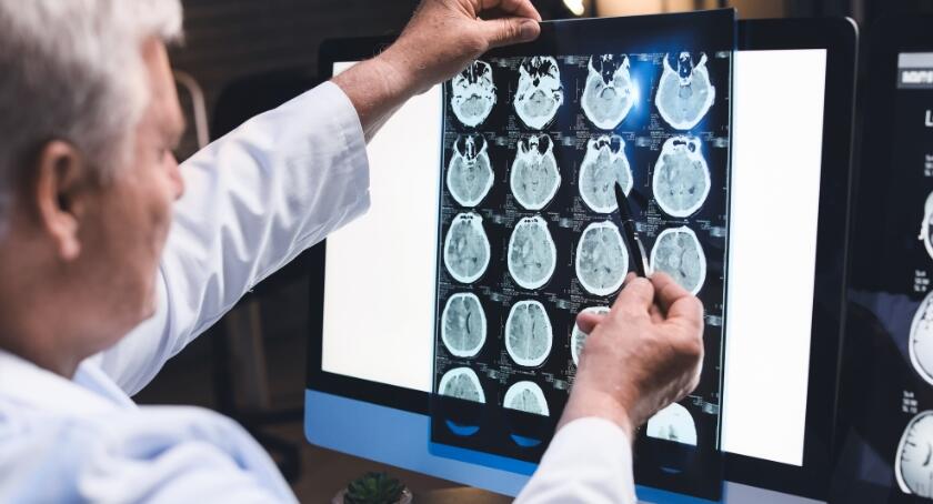 FDA OKs Roche's pTau217 Blood Test for Alzheimer's Assessment