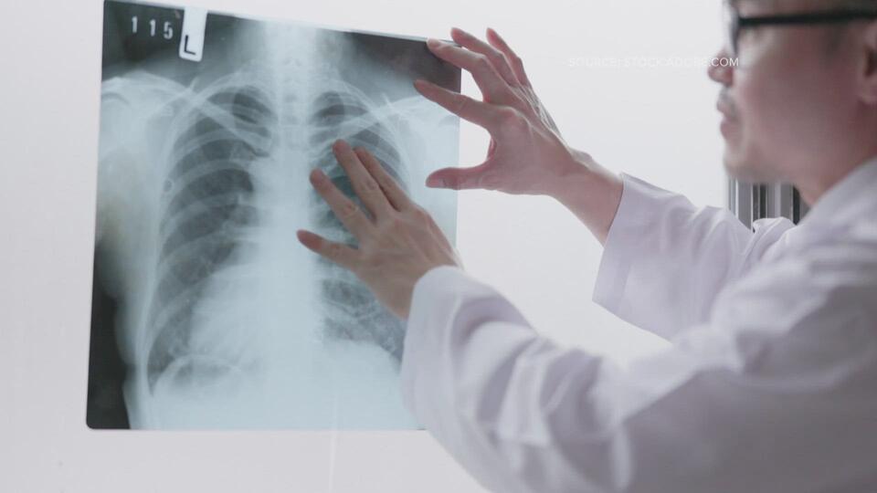 doctor-shares-tips-on-how-to-recognize-and-avoid-lung-cancer-part-1