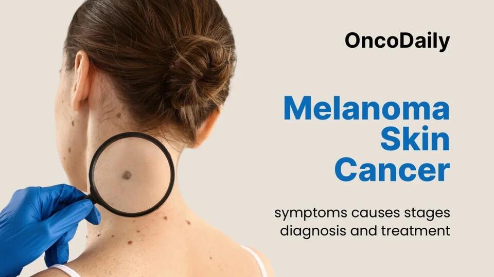 How AI in Skin Cancer Detection Is Changing Care for Patients - NewsBreak