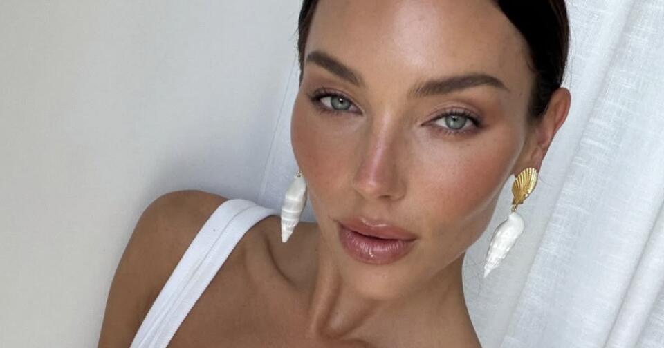 Model, 32, Thought She Had ‘Surfer’s Eye’—It Was Ocular Melanoma; Now She’s Urging Others To Get Routine Eye Exams