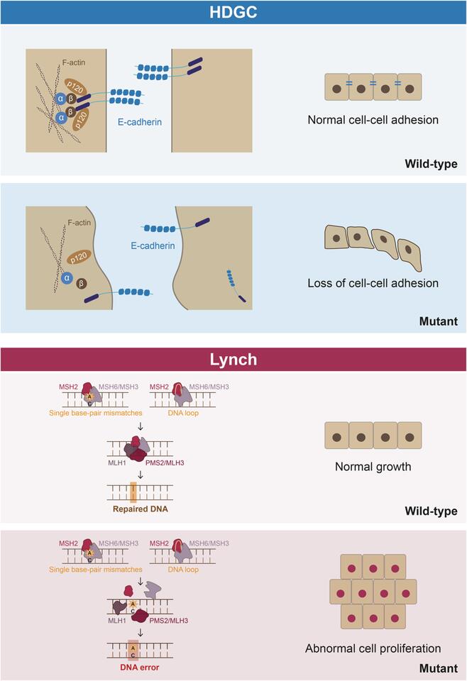 Hereditary diffuse gastric cancer in progress: Comparative lessons from ...