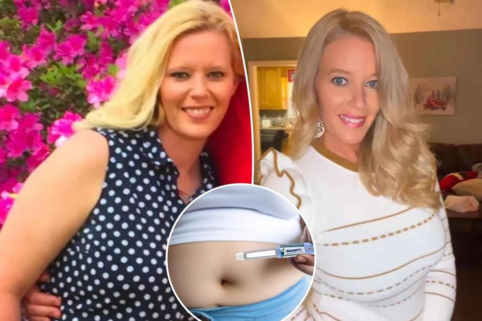 I work 3 jobs to pay for my semaglutide weight loss shots — now I’m ...