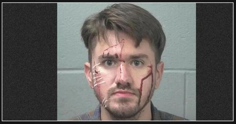 Texas Man Allegedly Self-Inflicts Facial Injuries with Razor Blade in ...