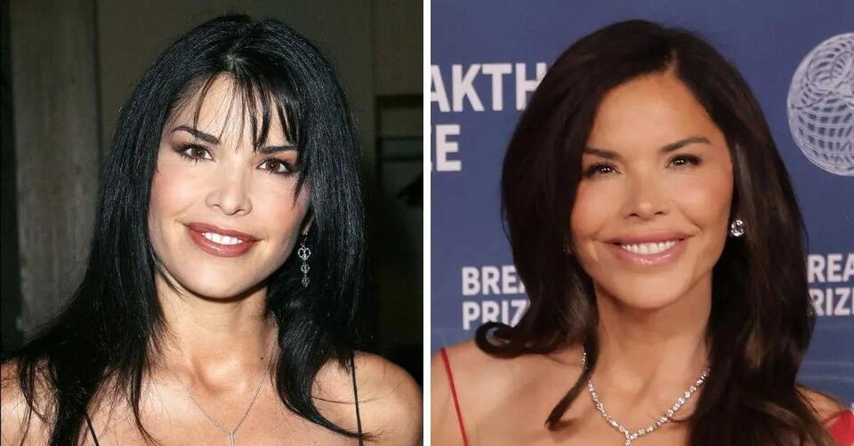 Did Lauren Sánchez Get Plastic Surgery? See Before and After Photos of ...