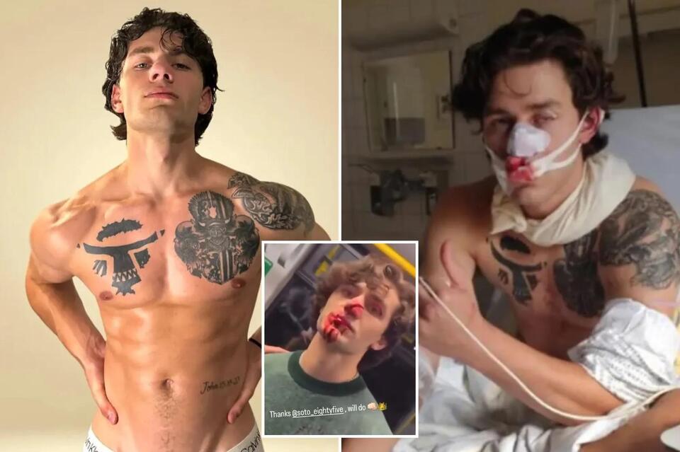 Syrian migrant accused of slashing hero American model John Rudat was ...