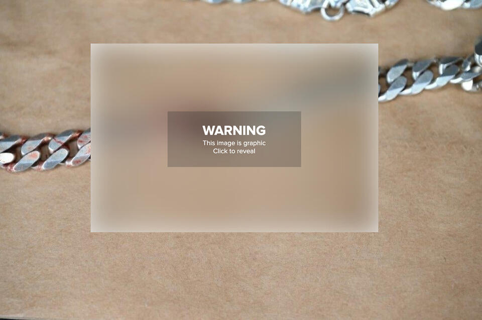 This Wild Picture Of A Colorado's Man's Fake Chain Is Going Viral ...