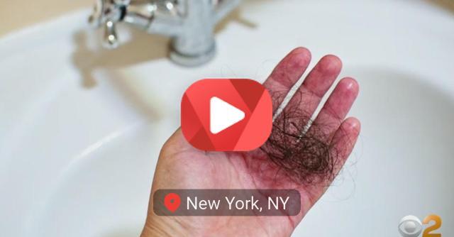 Some Women Suffering From Long COVID Say Extreme Hair Loss Is Among Symptoms – NewsBreak