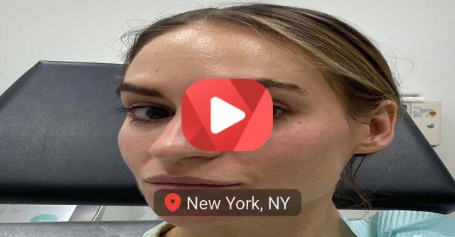 What Is Sofwave? Everything You Need to Know About the Skin-Tightening Device – NewsBreak